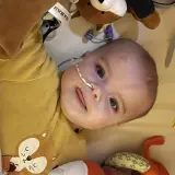 Un bébé avec une sonde nasogastrique, entouré de peluches. L'espoir d'une vie longue malgré la maladie de Pompe.