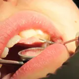 Un dentiste utilise des instruments pour examiner et potentiellement faire repousser les dents d'un patient.