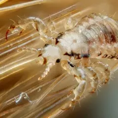 Gros plan d'un pou sur des cheveux. Ces parasites, d'où viennent les poux, se nourrissent de sang et s'accrochent aux cheveux.