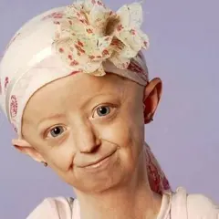 Jeune fille souriante portant un foulard fleuri, atteinte du syndrome de Hutchinson-Gilford.