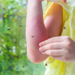 Un enfant se gratte le bras rouge, entouré de moustiques. Une image qui interroge : pourquoi les moustiques piquent certaines personnes ?