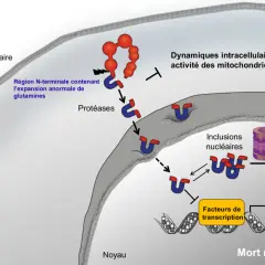 Schéma de la maladie de Huntington : une protéine anormale entre dans la cellule, perturbant les dynamiques cellulaires et menant à la mort neuronale, affectant l'espérance vie.