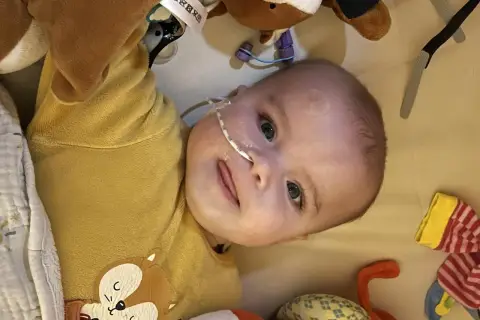 Un bébé avec une sonde nasogastrique, entouré de peluches. L'espoir d'une vie longue malgré la maladie de Pompe.