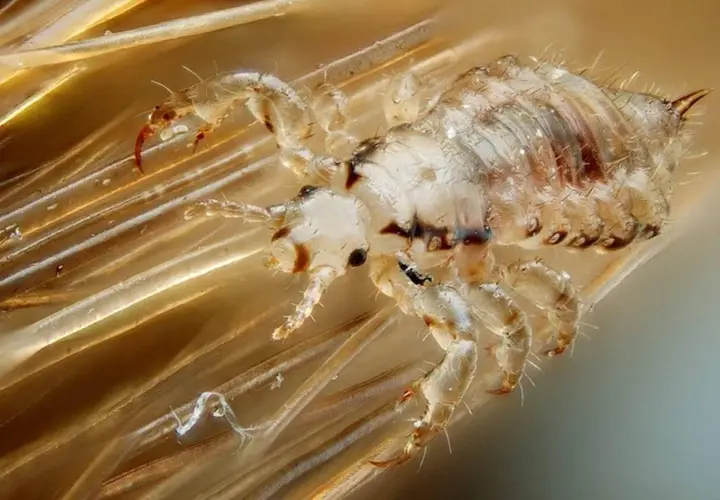 Gros plan d'un pou sur des cheveux. Ces parasites, d'où viennent les poux, se nourrissent de sang et s'accrochent aux cheveux.