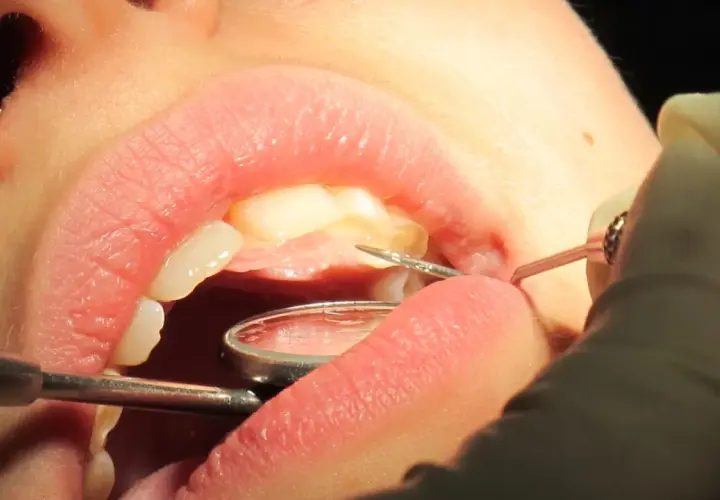 Un dentiste utilise des instruments pour examiner et potentiellement faire repousser les dents d'un patient.