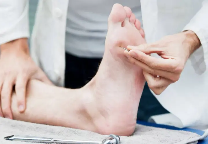 Un médecin teste la sensibilité d'un pied, suggérant un nouveau neuropathie traitement révolutionnaire.