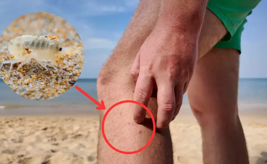 Puce des sables - Un crustacé, pas un insecte parasite !