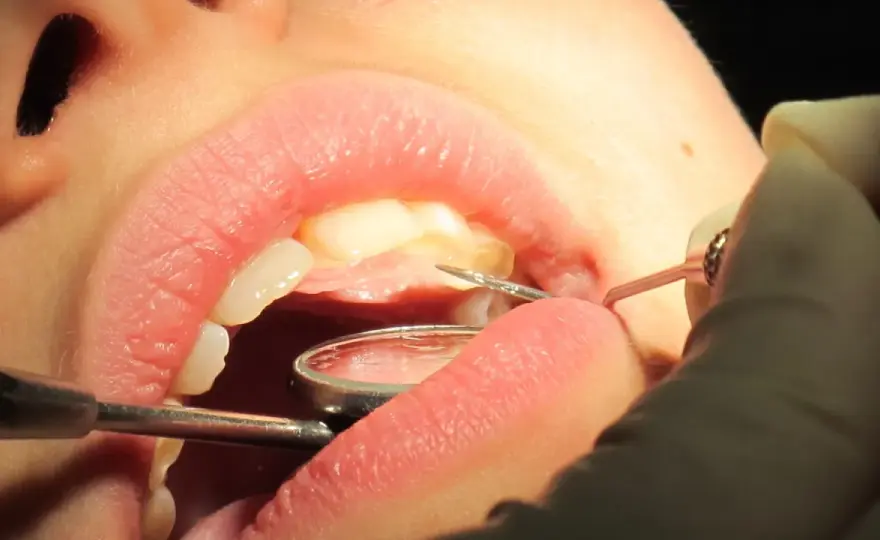 Faire repousser les dents, est-ce vraiment possible ?