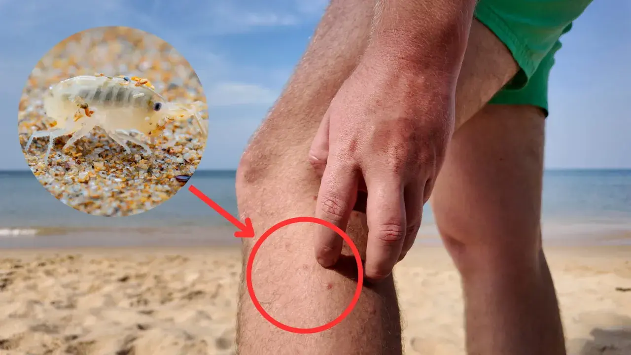 Gros plan sur une puce des sables sur le sable, avec une flèche rouge pointant vers des piqûres sur une jambe humaine.