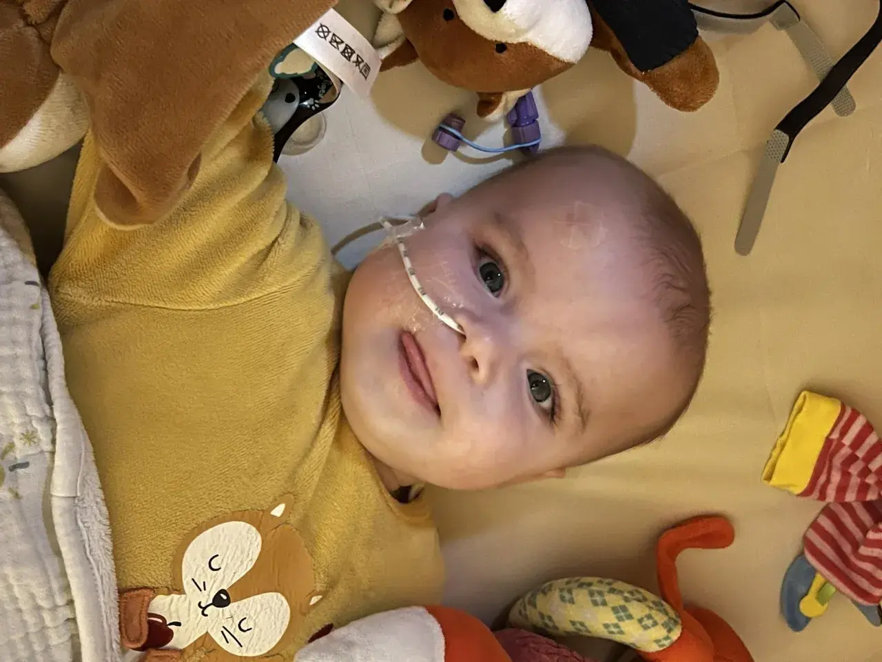 Un bébé avec une sonde nasogastrique, entouré de peluches. L'espoir d'une vie longue malgré la maladie de Pompe.