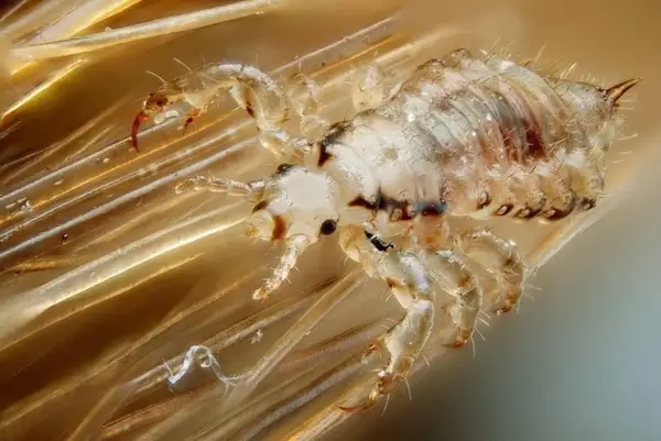 Gros plan d'un pou sur des cheveux. Ces parasites, d'où viennent les poux, se nourrissent de sang et s'accrochent aux cheveux.